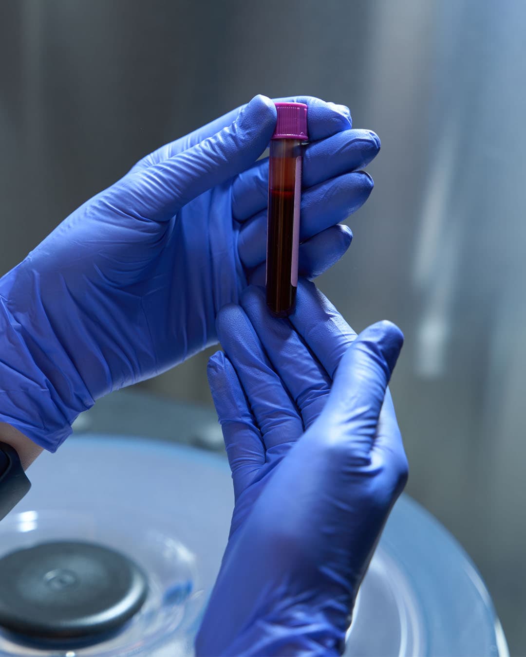 MTHFR Genotype Test